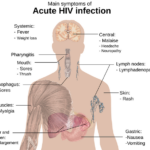 HIV এর পূর্ণরূপ, এইচআইভি লক্ষণ, এইডস এর ঔষধ, এর নাম এইডস কিভাবে হয়, এইডস এর ভাইরাসের নাম কি, এইডস কী, বাংলাদেশে এইডস এর চিকিৎসা, এইডস এর ঔষধ 2022, এইডস এর উৎপত্তি